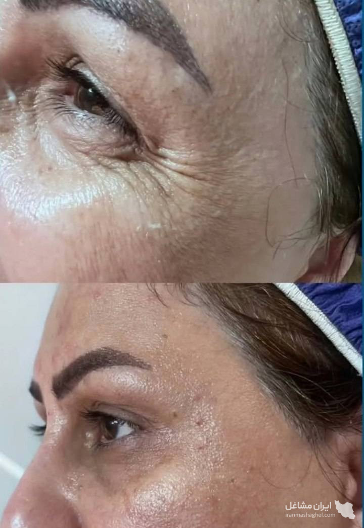 مرکز کاهش وزن و لاغری سایه در رشت